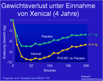 Gewichtsverlust unter Einnahme von Xenical (4 Jahre)